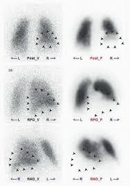 Pulmonary System Radiology Key