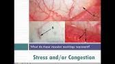 Iridology And Sclerology Youtube