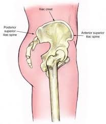 Image result for Intraosseous Access