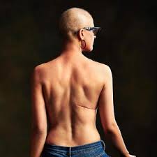 While a nagging cough is a telltale sign, the symptoms of lung. 10 Signs You May Have Lung Cancer Rediff Com Get Ahead