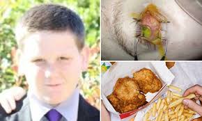 Teen was rapidly losing his vision until Sydney professor figured out  surprise cause