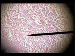 It has less ground substance than loose connective tissue. Slide 21 Dense Irregular Dermis Youtube