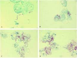 May 27, 2021 · ワクチン接種者の母乳中の抗体 3ヶ月前; Genomic Analysis Of A Raoultella Ornithinolytica Strain Causing Prosthetic Joint Infection In An Immunocompetent Patient Scientific Reports