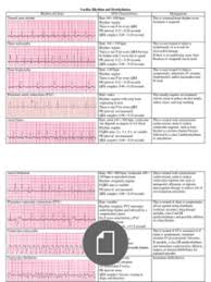 Cardiac Dysrhythmia Chart Med Surg Nur4 Cardiac Nursing