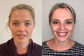 Benjamin Burt, MBBS, FACS, Oculoplastic Surgeon, Specialist in  Ophthalmology