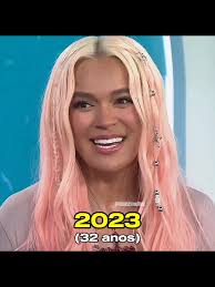 Karol G Before and After