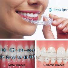 How much do braces cost? How Do Regular Dental Braces Cost Invisible Braces Braces Cost Teeth Straightening