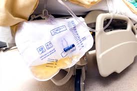 Image result for Urine Output