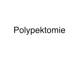 Polypektomie Darmpolypen Entfernen Medizin Fitness Ernahrung