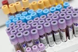 Evaluarea periodica a starii de sanatate este importanta in mentinerea unui standard de viata ridicat. Beneficiaza Gratuit De Analize De Laborator In Luna Noiembrie Reginamaria Ro