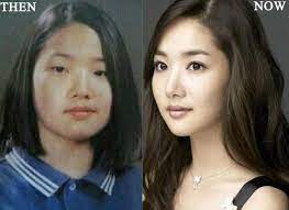 Park min young is a south korean actress under talent management agency namoo actors. Transformasi Park Min Young Mantan Lee Min Ho Yang Akui Oplas Kapanlagi Com
