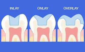 7 Tendercare Saltzman Ideas Dental Office Tigard Dentist