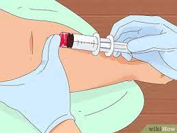 3 Ways To Lower Globulin Levels - Wikihow
