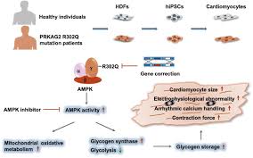 Establishment of a PRKAG2 cardiac syndrome disease model and mechanism  study using human induced pluripotent stem cells - Journal of Molecular and  Cellular Cardiology