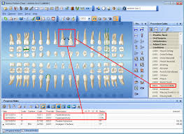 dentrix tip tuesdays charting conditions using condition codes