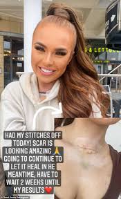 Demi jones has revealed she has been diagnosed with thyroid cancer following the removal of a demi made the announcement on instagram today where she said she will have an operation to. Demi Jones Reflects On Her Series Of Love Island Having The Highest Success Rate Of Couples Daily Mail Online