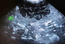 The technical name for this is the symptoms of hemangiosarcoma. Integrative Approaches To Canine Hemangiosarcoma Ivc Journal