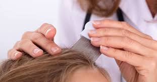 Alot of people don't know whether or not black people (or people with kinky/curly) hair can get lice. Lice Vs Dandruff Differences Pictures And Symptoms