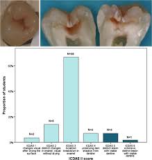 Показать на карте в реальном времени. Evaluating Performance Of Dental Caries Detection Methods Among Third Year Dental Students Abstract Europe Pmc