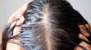 If surgery is a viable solution, our doctors can transplant healthy follicles from an area of. 12 Signs Of Hair Loss To Bring Up To Your Dermatologist Abc News