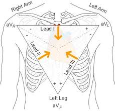 1 Einthoven Triangle Configuration For Ecg Electrode