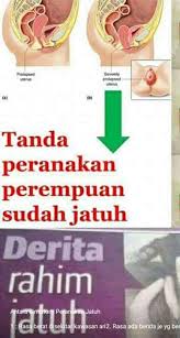 See more of merawat peranakan/rahim jatuh on facebook. Facebook