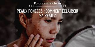 Peaux foncées : comment éclaircir sa peau ?