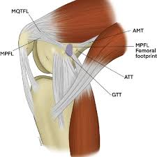 A dislocated kneecap is yet another common knee condition. Medial View Of A Flexed Knee Is Shown Anatomy Of The Mpfl Amt Download Scientific Diagram