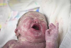 The fat in the moisturizer forms a thin layer on the skin, which replenishes and prevents further loss of moisture. Can You Use Baby Lotion On Your Newborn