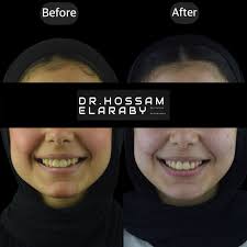 Elaraby Dental Center