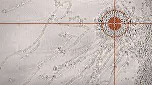 Die candidiasis entsteht meist durch candida albicans, zunehmend auch durch andere arten, z.b. Candida Albicans Temelia Multor Boli Viataverdeviu Ro