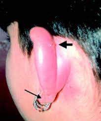 Cartilage Ear Piercing Information Healing Infections And Care Cartilage Piercing Infection Ear Piercing Care Cartilage Piercing Care