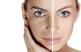 Lightsheer ® laser hair removal; Facial Laser Hair Removal Service In Victoria Maya Laser Clinic