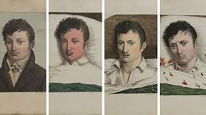 Image result for Yellow Fever