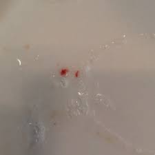 Blut Im Speichel Siehe Bild Hilfe Arzt Krebs Lunge