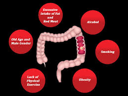 A personal history of inflammatory bowel disease (ibd) inflammatory bowel disease, which includes crohn's disease and ulcerative colitis, causes chronic inflammation of the colon. Colorectal Cancer Archives Oncoplus Hospital