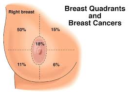 When only part of the tumor can be removed. Breast Cancer Naija247medic S Blog