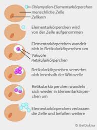 Sie wird auch als stille krankheit bezeichnet, da sich ihre symptome oft nur schwer zuordnen lassen oder sogar ganz fehlen. Chlamydien Symptome Ansteckung Behandlung Netdoktor
