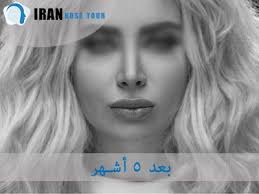ما هي جراحة الأنف Nose Movie Posters Iran