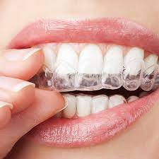 Best for heavy teeth grinding: Custom Mouth Guards St Peters Mo Confident Smiles And Implants