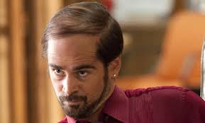 This is a normal hair parting. Balding Hairstyles How To Style Your Hair When You Re Losing It