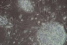 Jun 10, 2021 · cell engineering division in riken bioresource center (brc) was originally organized as the riken cell bank in 1987. Scientists Grow Two New Stem Cell Lines In Animal Cell Free Culture