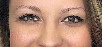 You can even have a microblading treatment done if you formerly had an eyebrow tattoo. Microblading Downtown La Los Angeles Ca Los Angeles Center For Cosmetic Surgery Plastic Surgeon