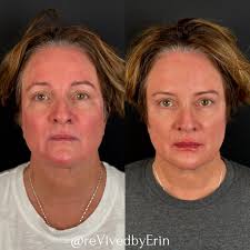 rēVive Medical Aesthetics