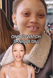 Discover Sanique Dill: The Rising Star Model