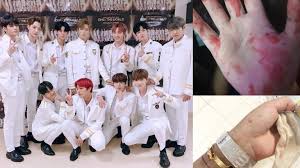 180119 wanna one first fanmeeting in malaysia welcome meeting 워너원제작보고회 bae jin young say their fav food is mee. Fan Got Beaten Up During Wanna One S Kuala Lumpur Concert