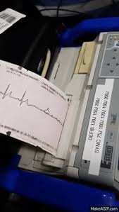 Search, discover and share your favorite defibrillator gifs. Ecg Version On Make A Gif