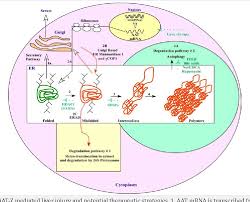 Early symptoms of lung disease are wheezing and fatigue. Pdf Alpha 1 Antitrypsin Deficiency Liver Disease Science And Therapeutic Potential 50 Years Later A Report From An International Research Conference On Alpha 1 At Semantic Scholar