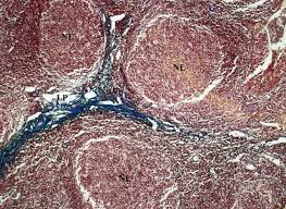 Image result for tonsilla palatina