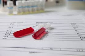 Le vgm est considéré comme normal. Nfs Quelles Sont Les Valeurs Normales